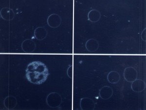 Live Blood Scan Perfect red and white blood cells, as well as platelets and plasma