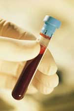 blood-vial Donate blood to USC